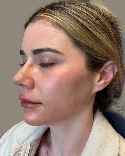 Laser Center of Marin Unveils Coordinated Bridal and Event Glow Package with Dermaplaning Finale